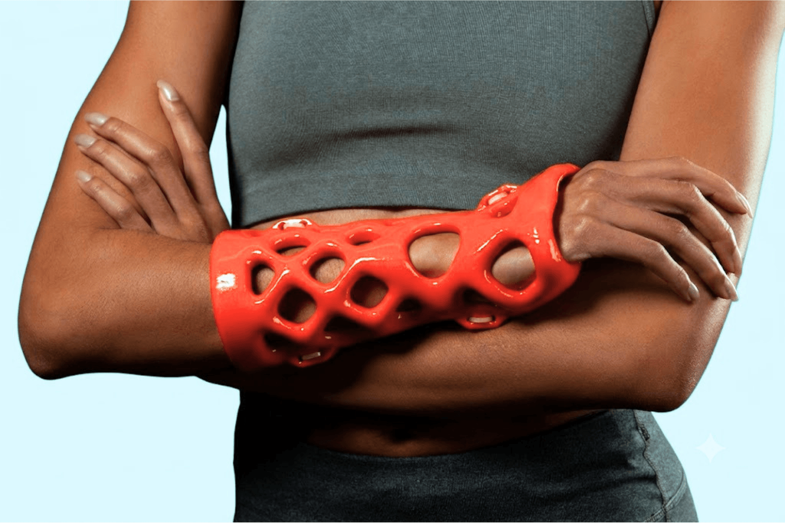 Lightweight breathable 3D printed cast